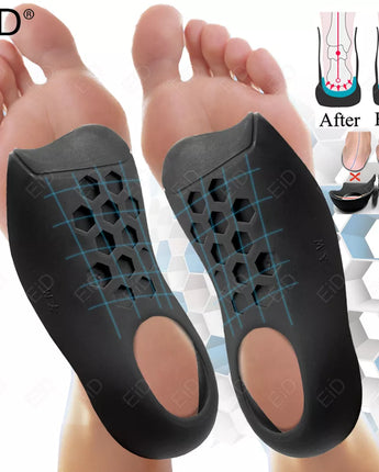 EiD Orthotic Insoles for XO-Legs Correction